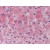 Formalin-Fixed, Paraffin Embedded Human Liver stained with APOC3 Antibody Cat.-No AP22902PU-N at 3 µg/ml after heat-induced antigen retrieval.