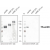 Western Analysis of anti-human esKDR. Samples were loaded in 10% SDS-polyacrylamide gel under reducing conditions.
Left panel: monoclonal antibody against the soluble KDR D1-7); Right panel: polyclonal antibody (peptide) against against the unique C-terminal end of esKDR.