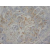 Immunohistochemical analysis of paraffin embedded Human ovary cancer section using GLUT4 antibody