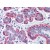 Human Breast: Formalin-Fixed, Paraffin-Embedded (FFPE)