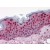 Human Skin: Formalin-Fixed, Paraffin-Embedded (FFPE)