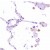 AM21062PU CD163 antibody staining of Human Lung.
