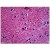 Human Brain, Cortex: Formalin-Fixed, Paraffin-Embedded.