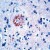 Human Alzheimer’s brain stained with anti-APP antibody