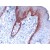 Human skin stained with anti-keratin 5 antibody