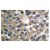 Immunohistochemistry (IHC) analyzes of MMP-19 pAb in paraffin-embedded human breast carcinoma tissue.