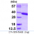 Recombinant human ACY3, 1-319 aa, His-tagged
