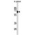 Western blot analysis of ABCD4 Antibody (Center) (Cat. #AP50020PU-N) in mouse spleen tissue lysates (35ug/lane). ABCD4 (arrow) was detected using the purified Pab.