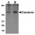 Western blot analysis of human brain lysate probed with Rabbit anti Human clusterin (AP05554PU-N) at 0.5(A) and 1(B) µg/ml