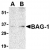 Western blot analysis of whole cell lysate from PC-3 human prostate cancer cells probed with Rabbit anti Human BAG1 (AP05586PU-N) at 1(A) and 2(B) µg/ml