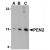 Western blot analysis of whole cell lysates from K562 human erythromyeloblastoid cells probed with Rabbit anti Human PEN2 (AP01104PU-N) at 0.5(A), 1(B) and 2(C) µg/ml.