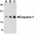 Western blot analysis of human heart lysate probed with Rabbit anti Human caspase-1 (SP2146P) at 0.5(A), 1(B) and 2(C) µg/ml