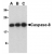 Western blot analysis of lysate from Jurkat human T-cell leukemia cells probed with Rabbit anti Human caspase-8 (AP05929PU-N) at 0.5(A), 1(B) and 2(C) µg/ml