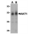 Western blot analysis of human liver cell lysate probed with Rabbit anti Human Akt1 (SP2174P) at 1(A) and 2(B) µg/ml