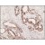 Formalin-Fixed, Paraffin-Embedded Human pancreatic tissue (4 µm) stained with anti-Cytokeratin 7 antibody (DB 051) shows positive immunostaining of pancreatic adenocarcinoma. Kindly performed and provided by Katarína Poliaková, MD and Ľubomír Straka, MD, Ph. D., from Clinical Pathology Prešov, Ltd., Prešov, Slovak republic.