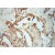 Immunohistochemistry of paraffin-embedded Lung cancer using 10164-2-AP(KRT13 Antibody) at Dilution 1:50 (under 10x lens)