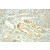 Immunohistochemistry of paraffin-embedded Ovary cancer using 10654-1-AP(HSPA8 Antibody) at Dilution 1:100 (under 25x lens)