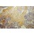 Immunohistochemistry of paraffin-embedded Ovary cancer using 10978-1-AP(HSD17B2 Antibody) at Dilution 1:100 (under 10x lens)