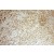 Immunohistochemistry of paraffin-embedded Breast cancer using 12789-1-AP(BCL2 Antibody) at Dilution 1:50 (under 10x lens)
