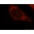 Immunofluorescent analysis of Hela cells, using HSD17B4 antibody 15116-1-AP at 1:25 dilution and Rhodamine-labeled goat anti-rabbit IgG (red).