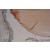 Immunohistochemistry of paraffin-embedded H-retina using 15808-1-AP(CRYAB Antibody) at Dilution 1:100 (under 10x lens)