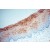 Immunohistochemistry of paraffin-embedded H-cervix using 16572-1-AP(KRT4 Antibody) at Dilution 1:100 (under 10x lens)