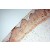 Immunohistochemistry of paraffin-embedded H-cervix using 17265-1-AP(KRT16 Antibody) at Dilution 1:100 (under 10x lens)