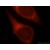 Immunofluorescent analysis of HepG2 cells, using TIMP2 antibody 17353-1-AP at 1:25 dilution and Rhodamine-labeled goat anti-rabbit IgG (red).