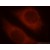Immunofluorescent analysis of MCF-7 cells, using KRT18 antibody 18708-1-AP at 1:25 dilution and Rhodamine-labeled goat anti-rabbit IgG (red).