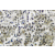 Immunohistochemical analysis using Androgen receptor antibody Cat.-No. AP06011PU-N in Paraffin-embedded human prostate carcinoma tissue.