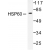 Western blot(WB) analysis ofHSP60/HSPD1  antibody in extracts from COLO205 cells.