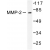Western blot(WB) analysis of MMP-2 antibody in extracts from LOVO cells.
.
