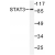 Western blot(WB) analysis of STAT3  antibody in extracts from K562 cells.