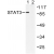 Western blot(WB) analysis of STAT3  antibody in extracts from HeLa cells.