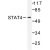 Western blot(WB) analysis of STAT4  antibody in extracts from HeLa cells.
