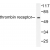 Western blot (WB) analysis of Thyroid Hormone Receptor α  antibody in extracts from SKOV3 cells.