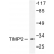 Western blot(WB) analysis of TIMP2 antibody in extracts from A549 cells.