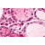 Immunhistochemistry analysis in human thyroid (Formalin-fixed, Paraffin-embedded) using GPR56 / TM7XN1 antibody Cat.-No. AP31896PU-N (N-term).