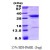 NCEH1 / AADACL1