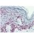 Immunohistochemistry showing Lamin C on Formalin fixed paraffin embedded skin tissue at 1/100