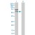 Western Blot analysis of CASP2 expression in transfected 293T cell line (H00000835-T02) by CASP2 MaxPab polyclonal antibody.
Lane 1: CASP2 transfected lysate(50.70 KDa).
Lane 2: Non-transfected lysate.