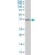 HSD17B1 monoclonal antibody (M03), clone 2E5 Western Blot analysis of HSD17B1 expression in Jurkat ( Cat # L017V1 ).