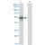 Western Blot analysis of KRT8 expression in transfected 293T cell line by KRT8 monoclonal antibody (M02), clone 3E3.
Lane 1: KRT8 transfected lysate(53.7 KDa).
Lane 2: Non-transfected lysate.