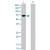 Western Blot analysis of MMP8 expression in transfected 293T cell line (H00004317-T01) by MMP8 MaxPab polyclonal antibody.
Lane 1: MMP8 transfected lysate(51.37 KDa).
Lane 2: Non-transfected lysate.