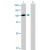 Western Blot analysis of STAT6 expression in transfected 293T cell line (H00006778-T01) by STAT6 MaxPab polyclonal antibody.

Lane 1: STAT6 transfected lysate(93.17 KDa).
Lane 2: Non-transfected lysate.
