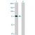 Western Blot analysis of ZYX expression in transfected 293T cell line (H00007791-T02) by ZYX MaxPab polyclonal antibody.

Lane 1: ZYX transfected lysate(61.30 KDa).
Lane 2: Non-transfected lysate.
