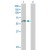 Western Blot analysis of ACCS expression in transfected 293T cell line (H00084680-T01) by ACCS MaxPab polyclonal antibody.

Lane 1: PHACS transfected lysate(55.11 KDa).
Lane 2: Non-transfected lysate.
