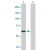 Western Blot analysis of ACCS expression in transfected 293T cell line (H00084680-T01) by ACCS MaxPab polyclonal antibody.

Lane 1: PHACS transfected lysate(57.30 KDa).
Lane 2: Non-transfected lysate.
