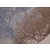 Immunohistochemistry staining of tonsil ( paraffin - embedded sections ) with KRT10/KRT13 monoclonal antibody, clone DE - K13 ( Cat # MAB0979 ) . The antibody DE - K13 stains only Cytokeratin 13 when used on formalin - fixed, paraffin - embedded tissue sections.