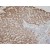Immunohistochemistry of human liver tissue was incubated with AK3 monoclonal antibody , clone SJB3 - 36 ( 1 : 100 ) ( Cat # MAB1065 ) for 2 hours at room temperature. Slide was then washed in PBS , and was incubated in avidin biosystem anti - rabbit labeled polymer for 30 min at RT. Enzyme detection was performed with DAB chromogen.
